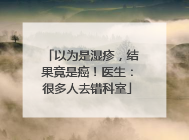 以为是湿疹，结果竟是癌！医生：很多人去错科室