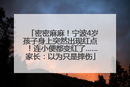 密密麻麻！宁波4岁孩子身上突然出现红点！连小便都变红了……家长：以为只是摔伤