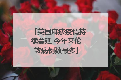 英国麻疹疫情持续蔓延 今年来伦敦病例数最多