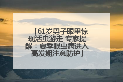 61岁男子眼里惊现活虫游走 专家提醒：夏季眼虫病进入高发期注意防护